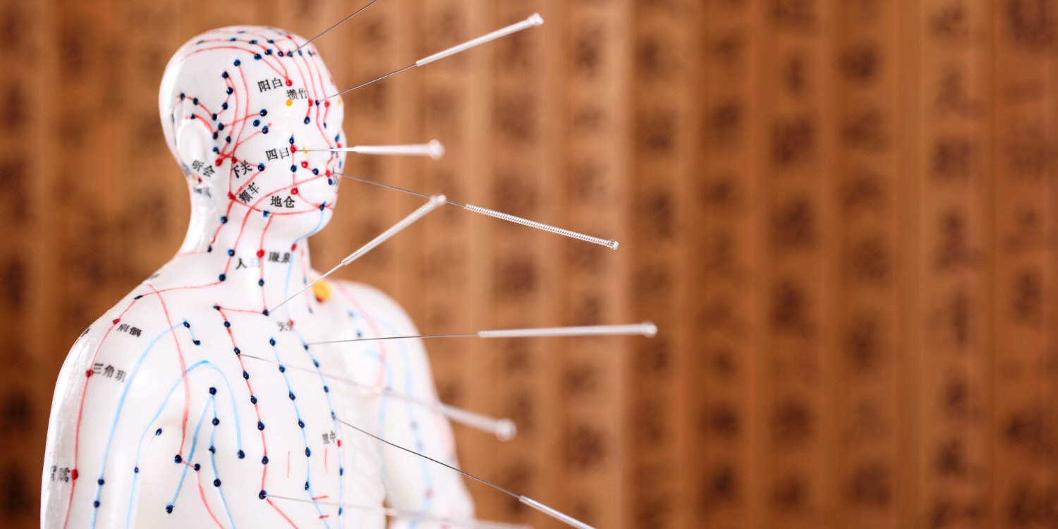 Acupuncture